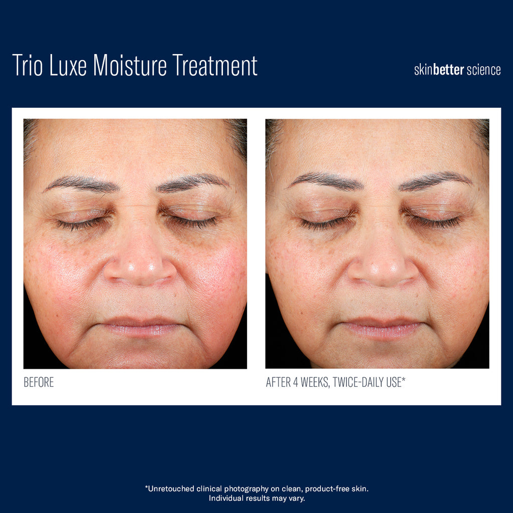 Trio Luxe Moisture Treatment