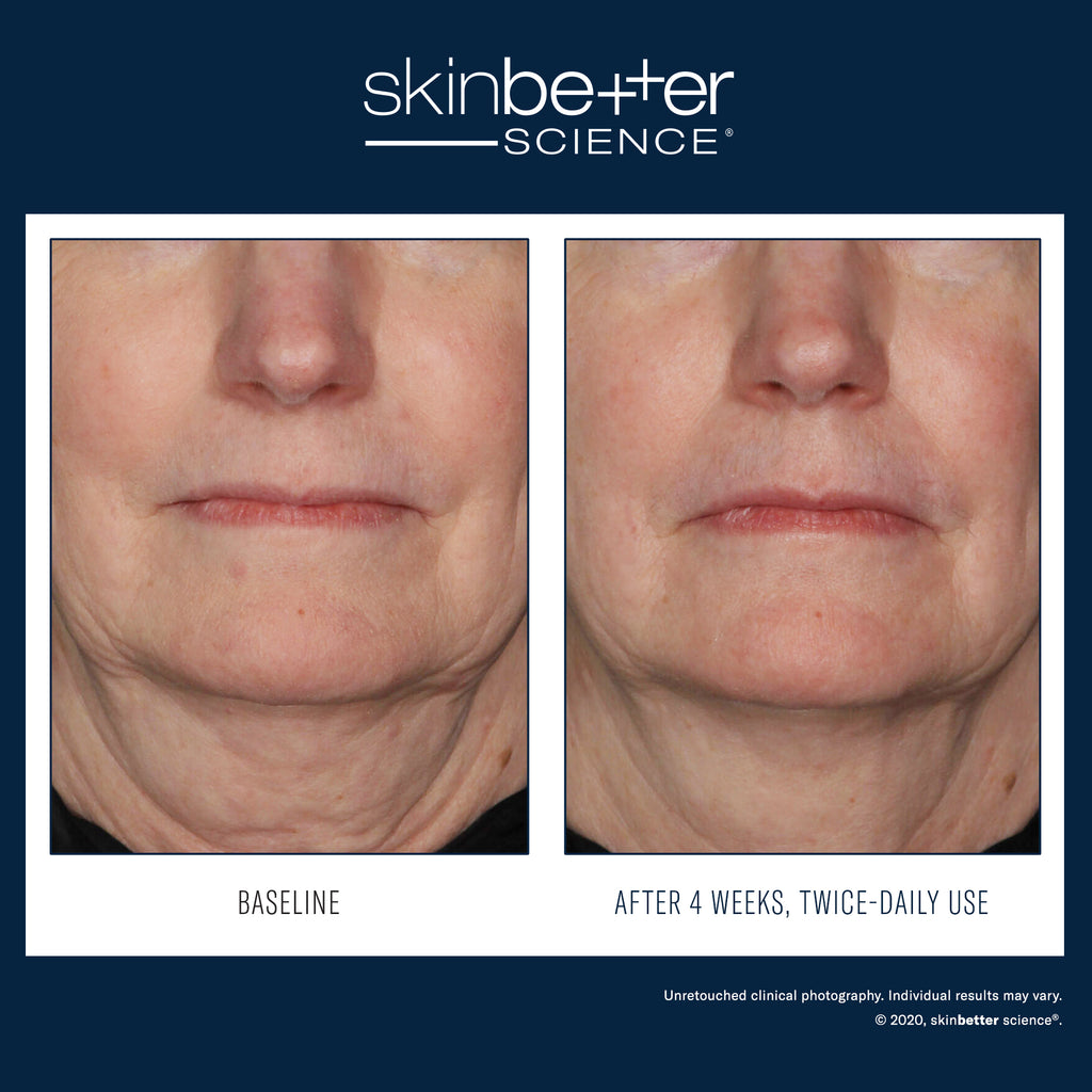 Interfuse Treatment Cream - Face and Neck