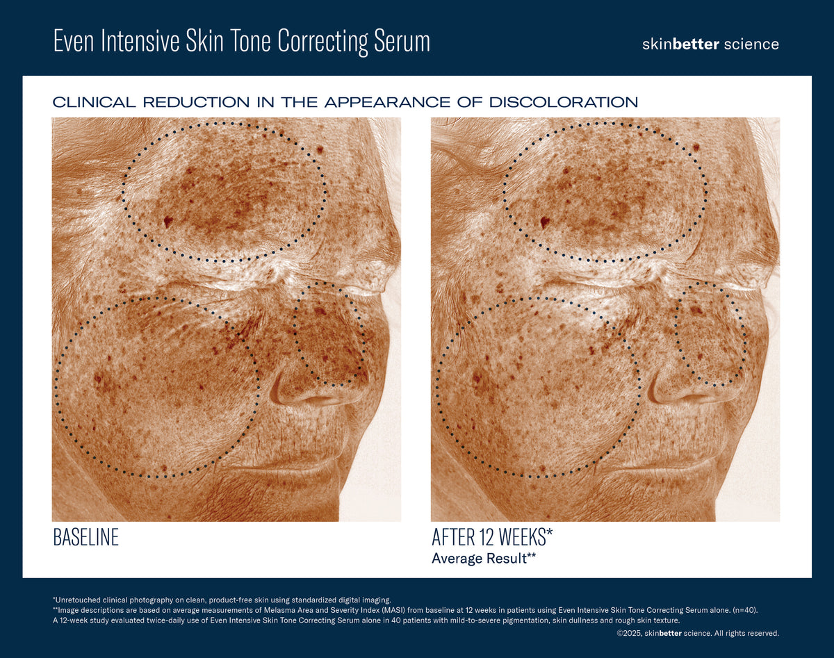Even Intensive Skin Tone Correcting Serum