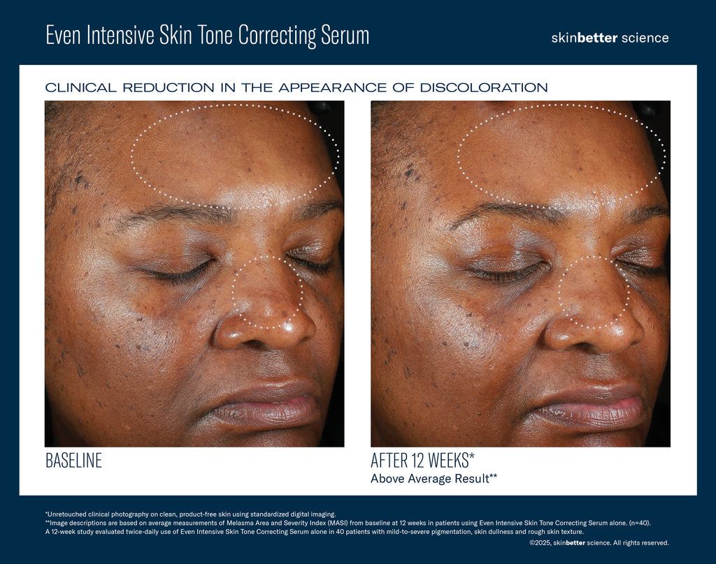 Even Intensive Skin Tone Correcting Serum