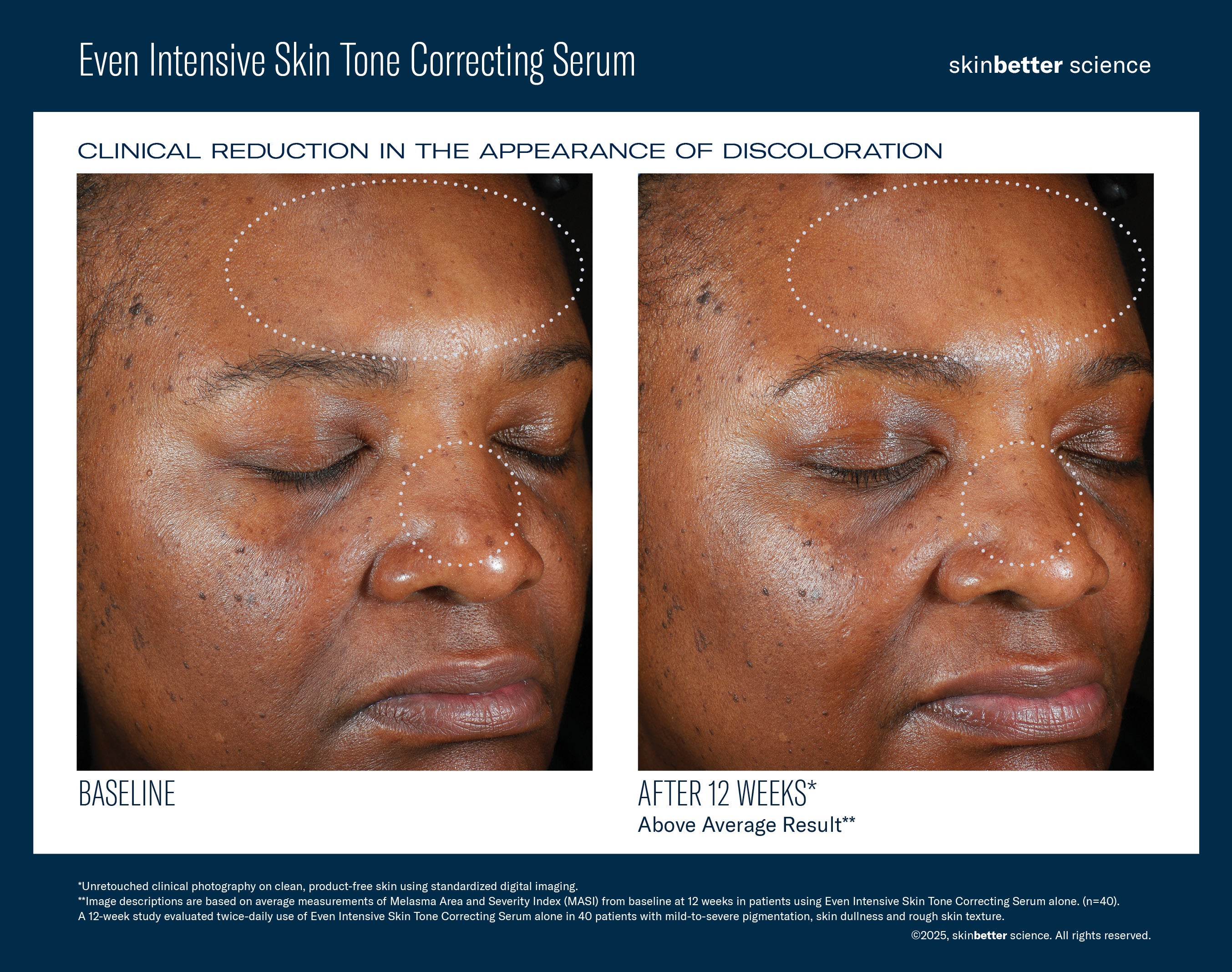 Even Intensive Skin Tone Correcting Serum